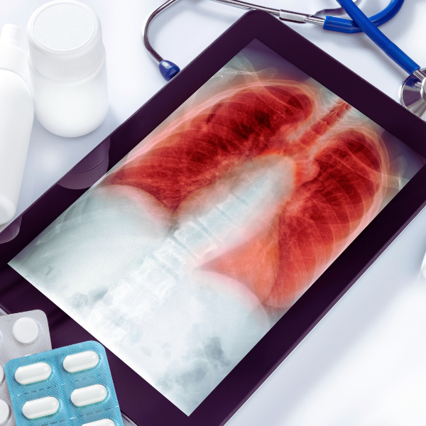 Soins inutiles : quand radios, pilules et examens pèsent lourdement sur la facture