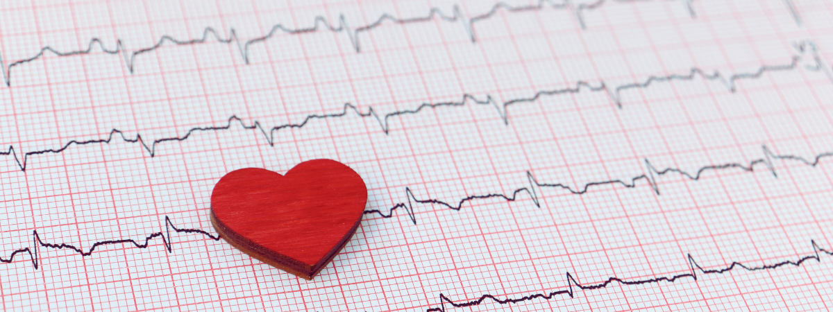 HFpEF: enquête nationale sur les pratiques du terrain